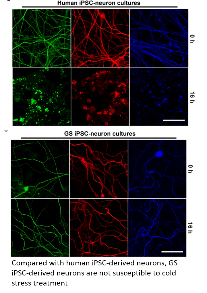 Compared with human iPSC-derived neurons, GS iPSC-derived neurons are not susceptible to cold stress treatment.