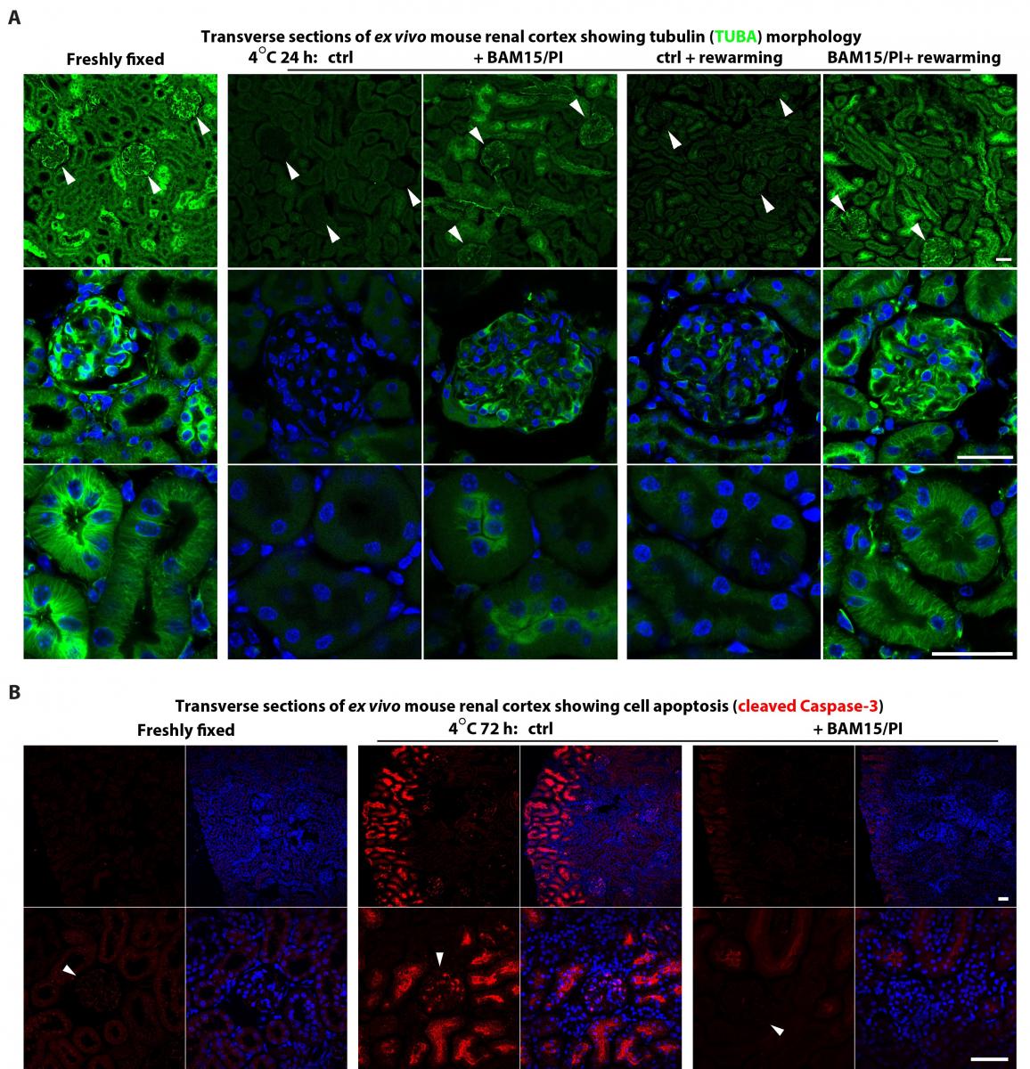  This Figure shows pretreatments with the mitochondrial inhibitor Bam15 and/or protease inhibitors (Pi) preserved microtubule morphology following 24-h cold storage and 2-h rewarming, and reduced cell apoptosis following 72-h cold storage. 